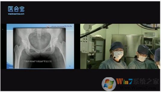 醫(yī)會寶醫(yī)學直播軟件